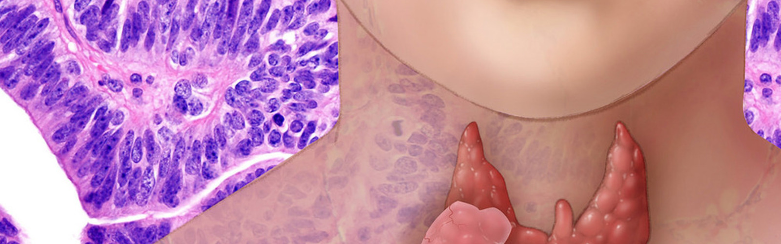 Is Your Thyroid Healthy?