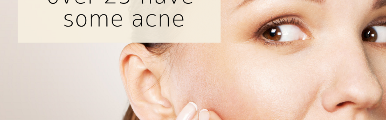 Why Is Adult Acne on the Rise?